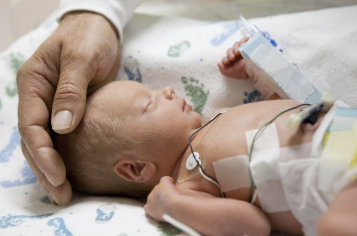 Mengapa Bayi yang Kekurangan Surfaktan Dapat Mengalami Asfiksia Neonatorum