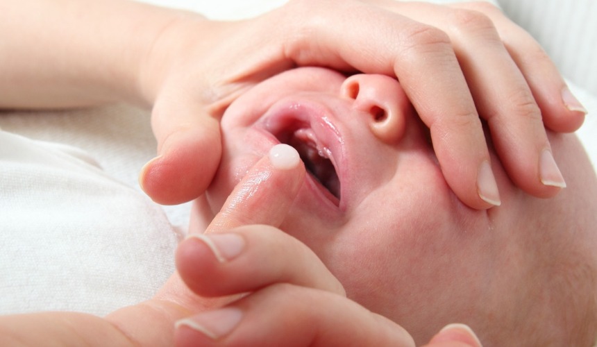 Penyebab Infeksi Jamur Pada Mulut Bayi