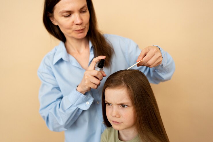 4 Cara Menghilangkan Kutu Rambut Dengan Cepat Menggunakan Bahan Alami Pada Anak