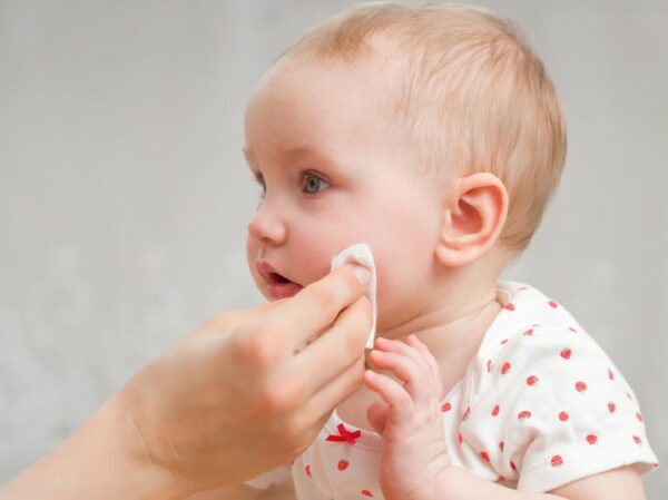 7 Cara Menghilangkan Bintik Merah Di Wajah Bayi Secara Alami