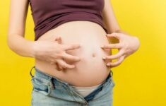 bagaimana cara mengatasi gatal di perut saat hamil