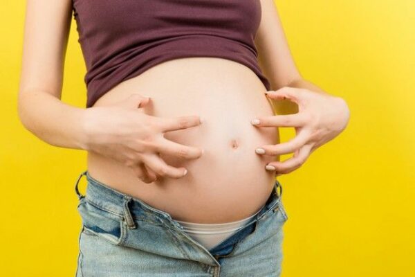 bagaimana cara mengatasi gatal di perut saat hamil