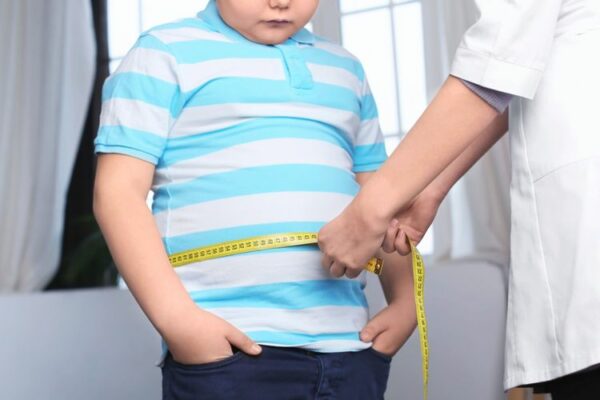 kapan anak disebut obesitas