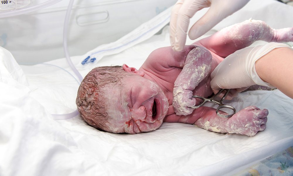 vernix caseosa pada bayi baru lahir