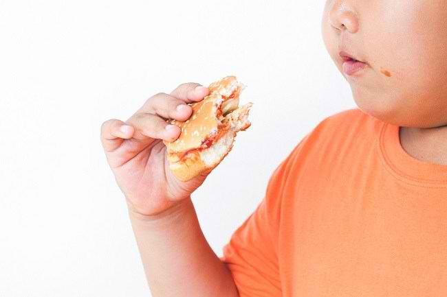 Bagaimana cara mengatasi obesitas pada anak