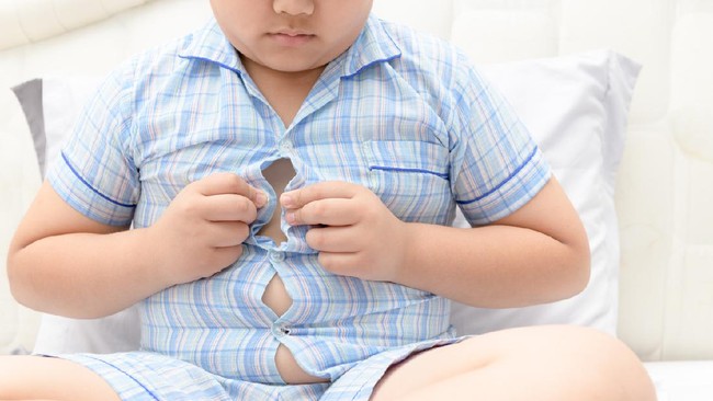 Bagaimana cara mengatasi obesitas pada anak