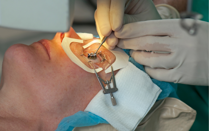 LASIK Mata