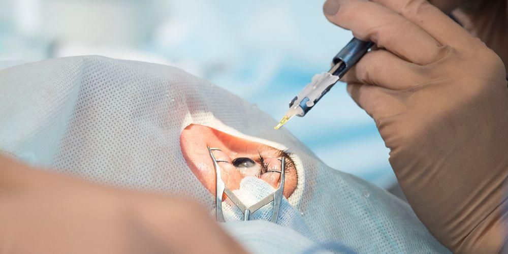 Operasi Lasik Mata