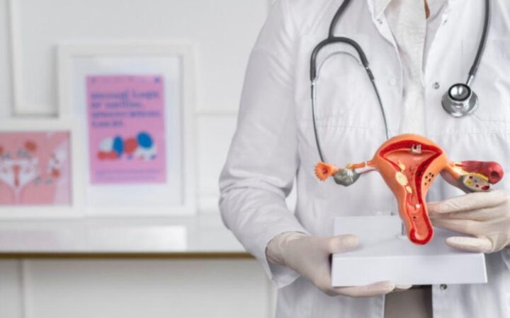 Perawatan Terpadu PMOS untuk Kesehatan Reproduksi Perempuan